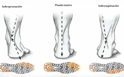 Cómo saber que tipo de pisada tienes